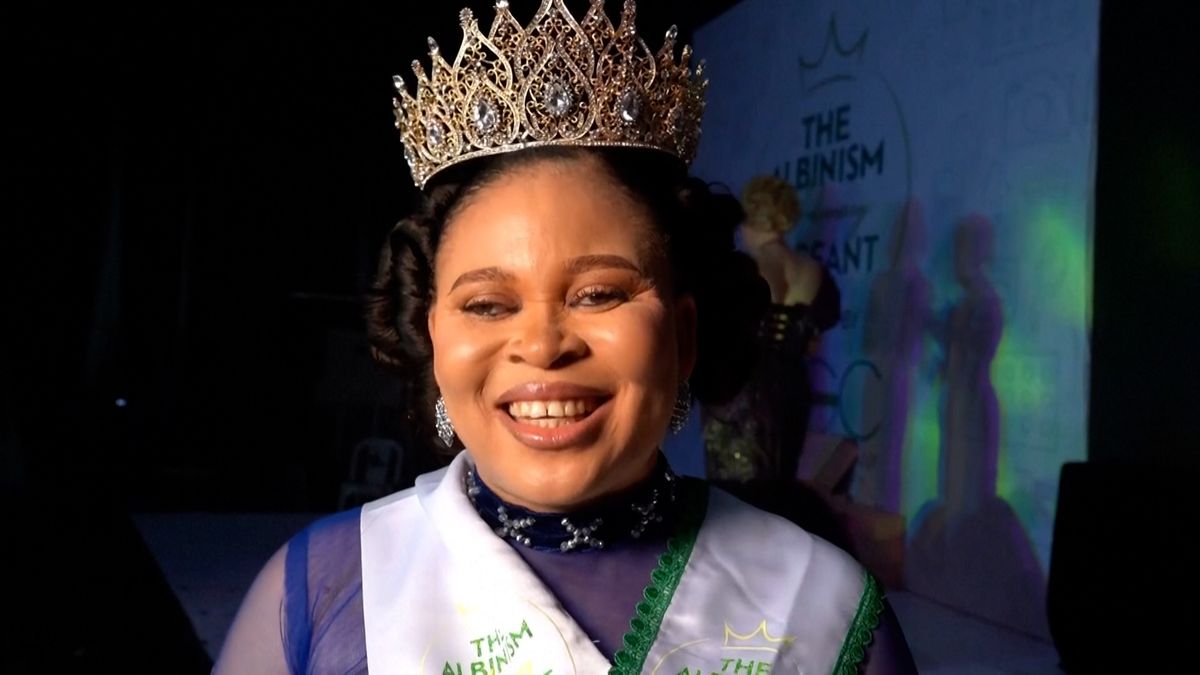 V Nigérii zvolili albínskou královnu krásy